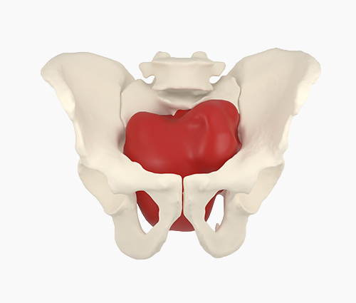 Virtual Surgery Planning (VSP)